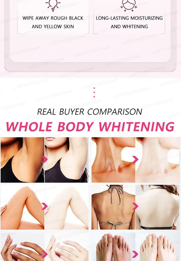 Whitening Cream Private Parts Underarm Bleaching Serum Whiten Butt Knee Brighten Inner Thigh Intimate Parts Dark Remove Melanin