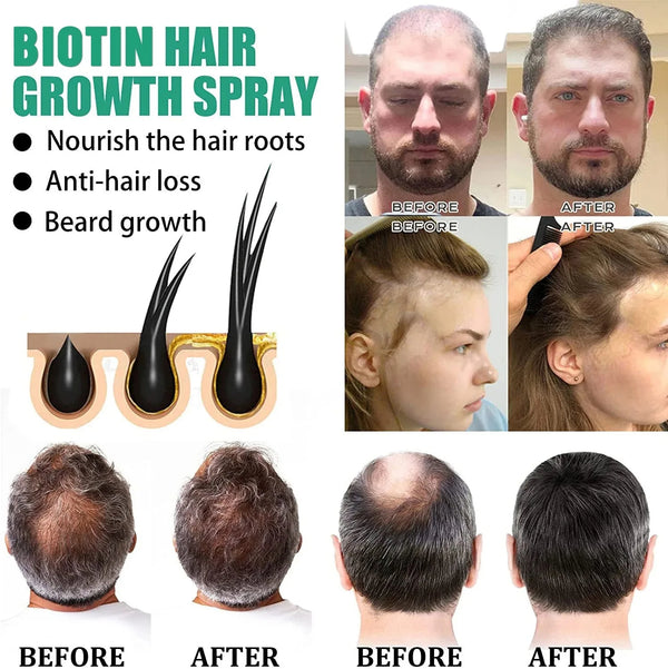 Biotin Fast Hair Growth Products for Men Women Anti Hair Loss Serum Spray Scalp Treatment Thicken Regrowth Oil Hair Care