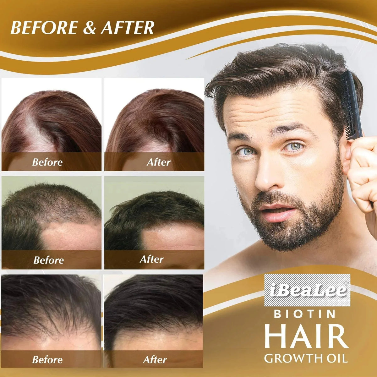 Biotin Fast Hair Growth Products for Men Women Anti Hair Loss Serum Spray Scalp Treatment Thicken Regrowth Oil Hair Care